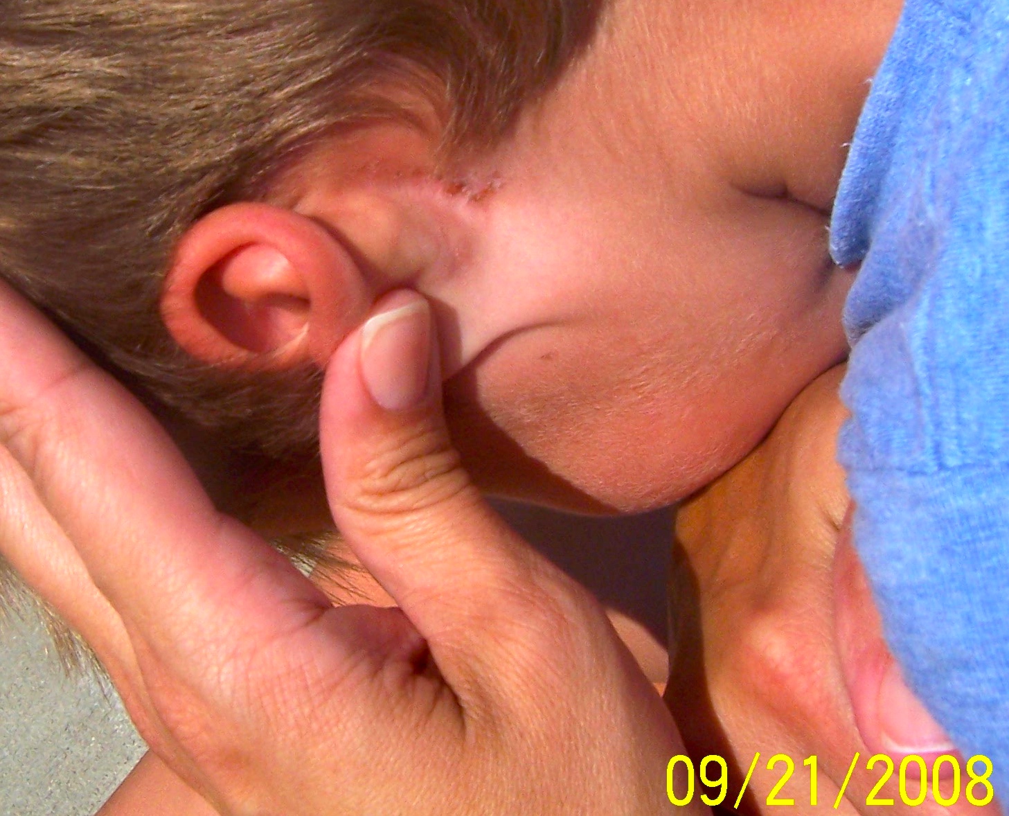 'Jeremy' ear